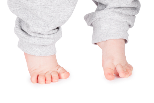 歳 つま先 歩き 1 1歳4ヶ月になる息子のつま先歩きについて。1歳前（11ヶ月）に歩き出し、1歳